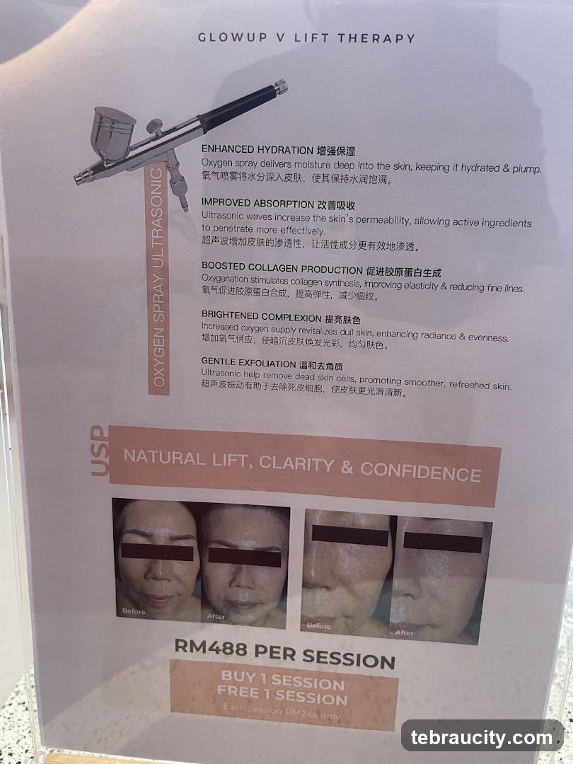Glowup V Lift Therapy